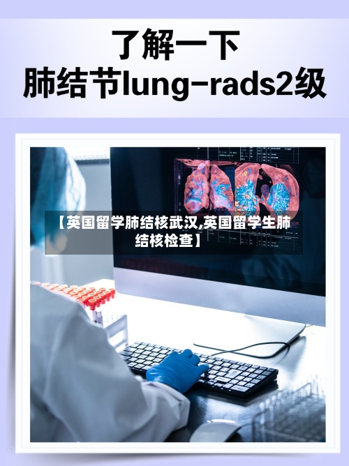 【英国留学肺结核武汉,英国留学生肺结核检查】