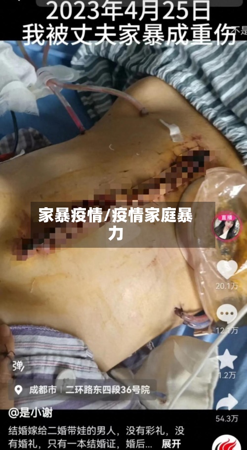 家暴疫情/疫情家庭暴力