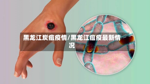 黑龙江炭疽疫情/黑龙江瘟疫最新情况