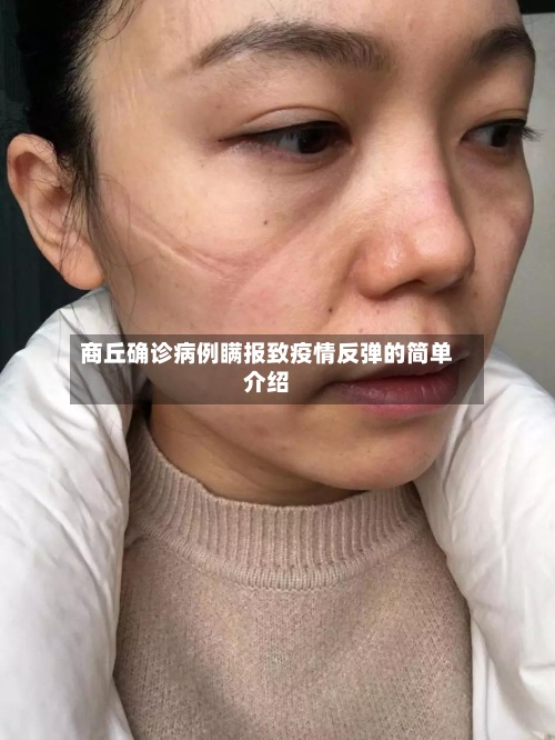 商丘确诊病例瞒报致疫情反弹的简单介绍-第2张图片