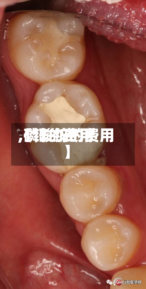 【锌的费用
,磷酸锌的费用
】