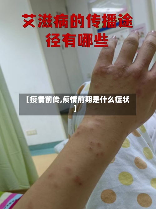【疫情前传,疫情前期是什么症状】-第2张图片