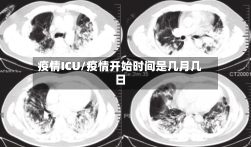 疫情ICU/疫情开始时间是几月几日