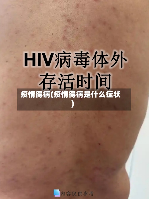 疫情得病(疫情得病是什么症状)-第2张图片