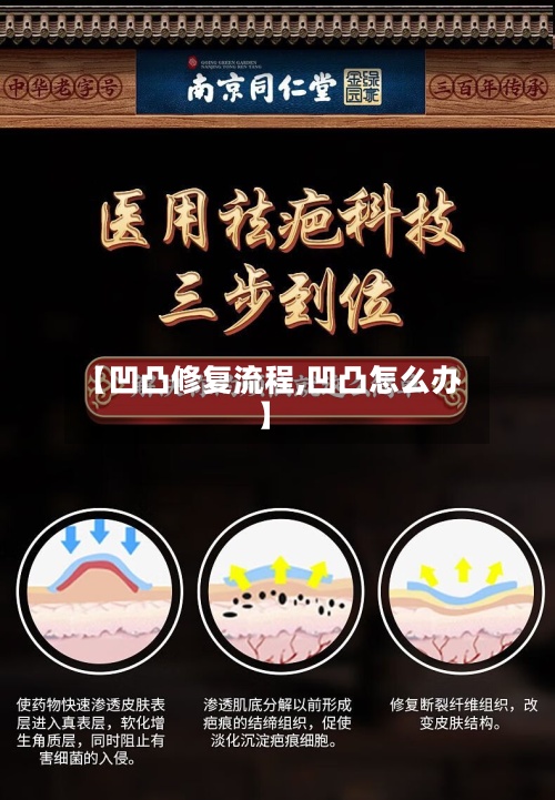 【凹凸修复流程,凹凸怎么办】-第2张图片