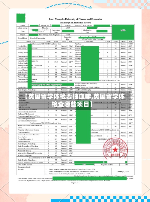 【英国留学体检要抽血嘛,英国留学体检查哪些项目】-第2张图片