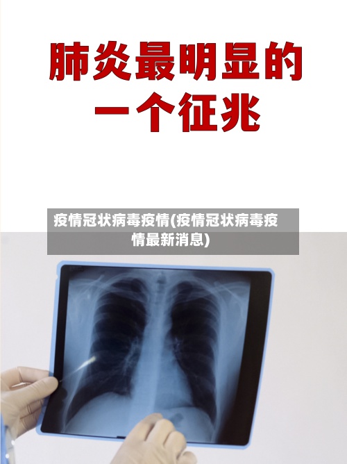 疫情冠状病毒疫情(疫情冠状病毒疫情最新消息)-第3张图片
