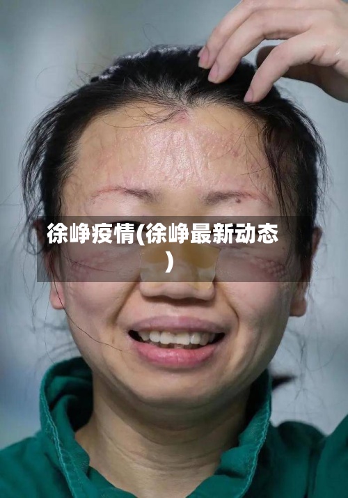 徐峥疫情(徐峥最新动态)-第3张图片