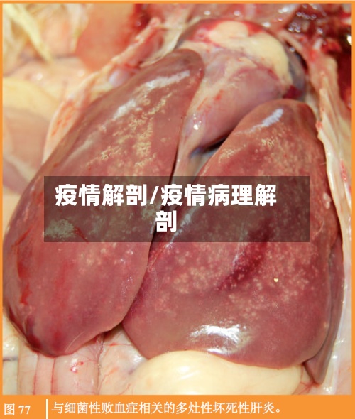 疫情解剖/疫情病理解剖