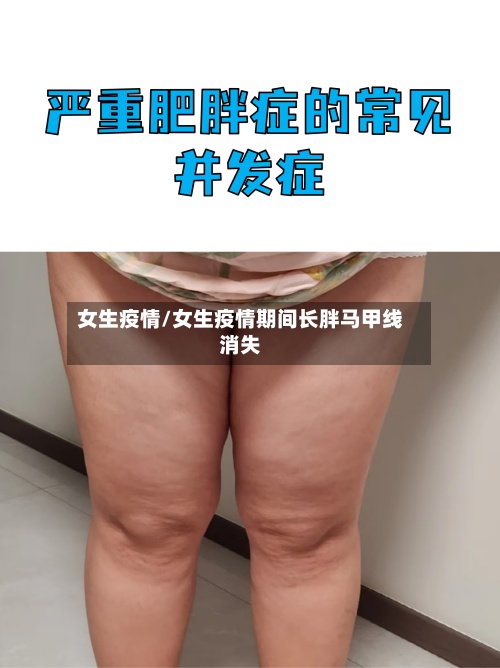 女生疫情/女生疫情期间长胖马甲线消失-第2张图片