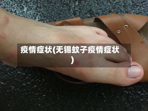 疫情症状(无锡蚊子疫情症状)