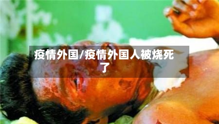 疫情外国/疫情外国人被烧死了