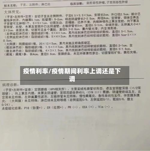 疫情利率/疫情期间利率上调还是下调