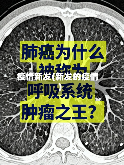 疫情新发(新发的疫情)-第2张图片