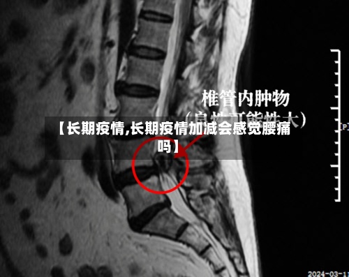 【长期疫情,长期疫情加减会感觉腰痛吗】