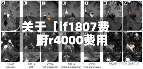 关于【if1807费用
,ifr4000费用
】-第3张图片