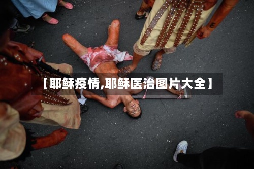 【耶稣疫情,耶稣医治图片大全】