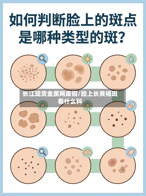 长江现货金属网废铜/脸上长黄褐斑看什么科-第3张图片