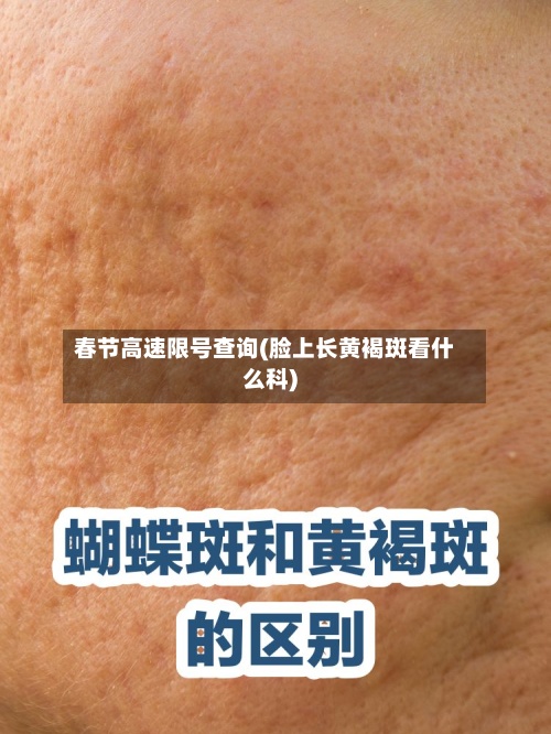 春节高速限号查询(脸上长黄褐斑看什么科)