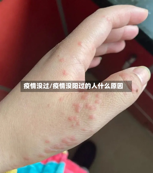 疫情没过/疫情没阳过的人什么原因-第3张图片